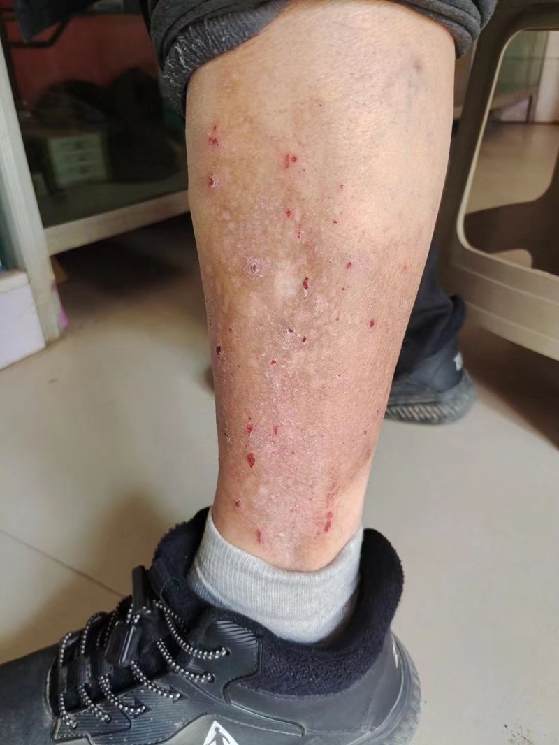 京城皮肤病医院助力肌肤重焕光彩